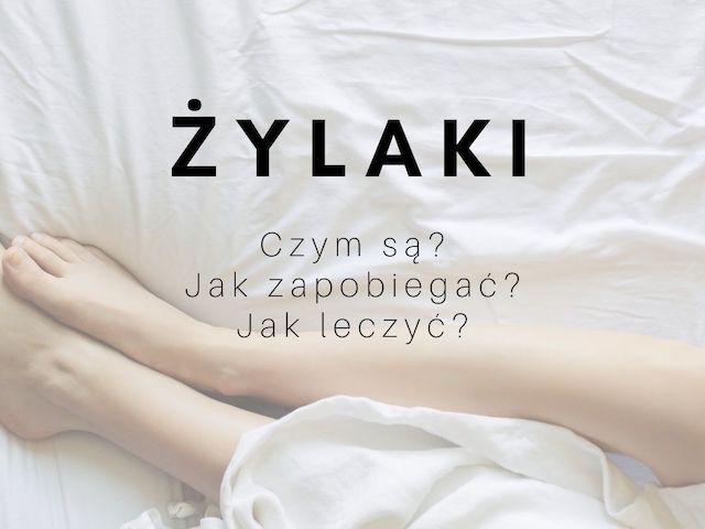 Żylaki - lepiej zapobiegać niż leczyć!